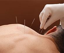 Homeopatia e Acupuntura